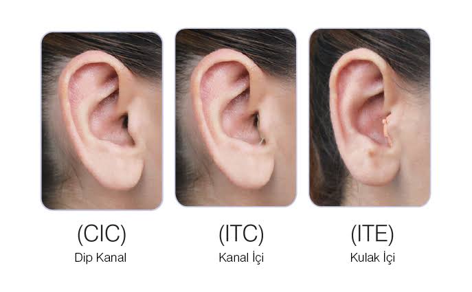 Kulak içi işitme cihazı modelleri