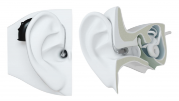 Kulak içi mi, Kulak Arkası mı İşitme Cihazı Kullanmalıyım ?